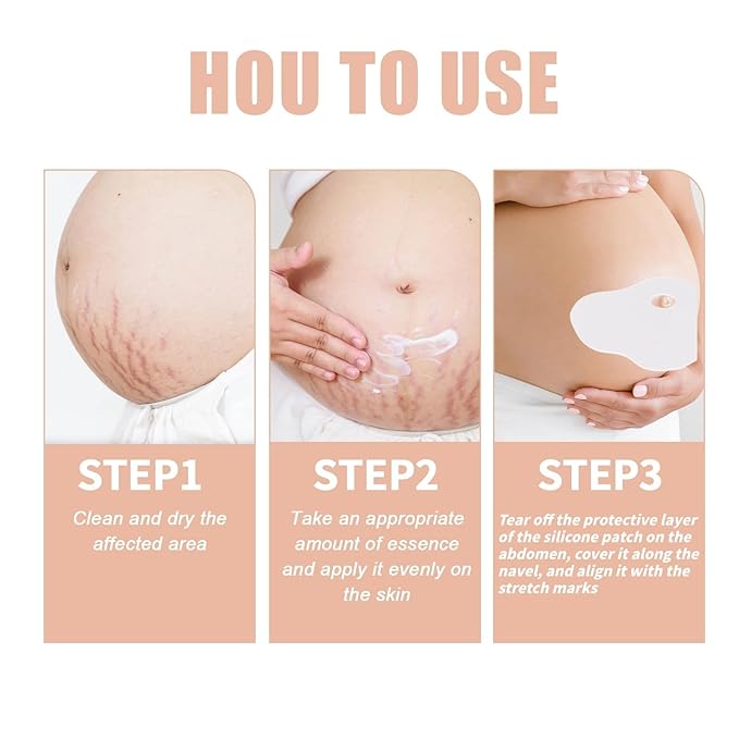 Silicone Patches for Stretch Marks, Anti Wrinkle Stretch Removal Sheet for Pregnant Women, Washable Reusable Skin Lifting & Tightening Silicone Tummy Sticker Belly Stickers Stretch Marks Pad (2pcs)