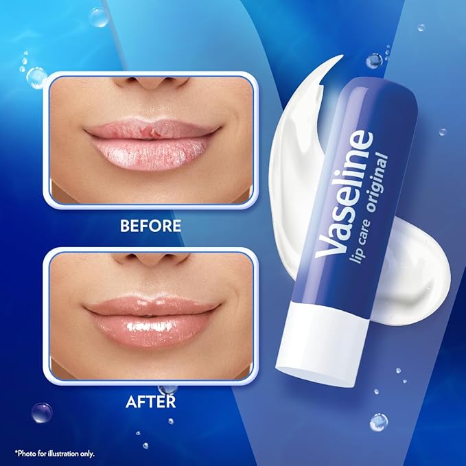 Vaseline Lip Therapy Care Original, Fast-Acting Nourishment, Ideal for Chapped, Dry, Cracked, or Damaged Lips, Lip Balm, 3-Pack of 2, 0.16 Oz Each, 6 Lip Balms