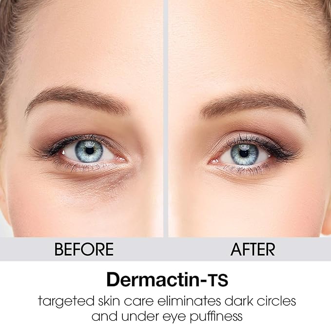 Dermactin-TS Stretch Mark Complex Concentrated Formula 177ml by Dermactin by Dermactin