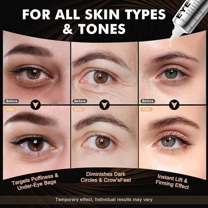 KKP Perfection Eye Tightener with Brush, Instant Firming Formula #526589 (20ML)