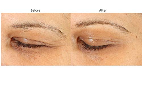 Bluelene EyePlus+, a new formula powered by the ultimate trifecta of Methylene Blue, Ergothioneine, and Niacinamide. Dermatologist approved. Suitable for Sensitive Skin.