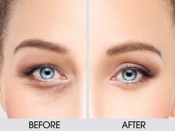 Dermactin Classic Upper Eyelid Revitalizing Eye Cream 1 oz.
