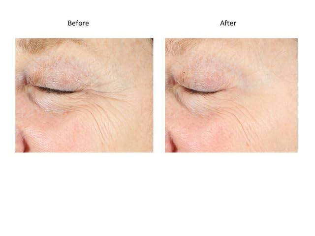 Bluelene EyePlus+, a new formula powered by the ultimate trifecta of Methylene Blue, Ergothioneine, and Niacinamide. Dermatologist approved. Suitable for Sensitive Skin.