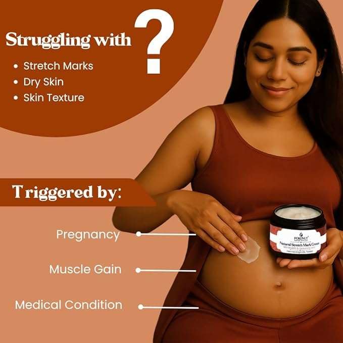 YMPIGOY POKONUT Ayurvedic Stretch Mark Cream | Improves Appearance of Fresh and Mature Stretch Marks | Infused with Hyaluronic Acid & Rosehip Oil | Natural and Cruelty-Free | 50 gm