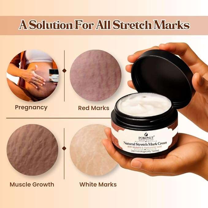 YMPIGOY POKONUT Ayurvedic Stretch Mark Cream | Improves Appearance of Fresh and Mature Stretch Marks | Infused with Hyaluronic Acid & Rosehip Oil | Natural and Cruelty-Free | 50 gm