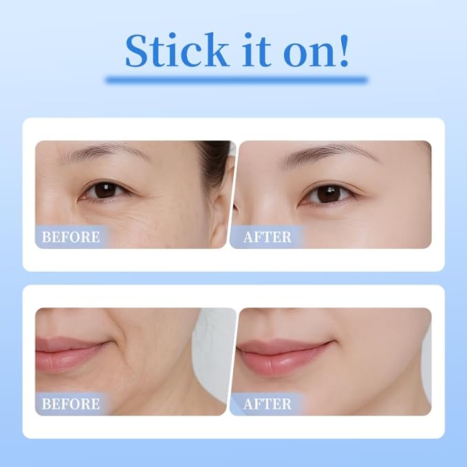 4 pairs PDRN Micro Eye Patches, Under Eye Patches for Puffy eyes, Dark Circles & Wrinkle | Hyaluronic Acid, Kojic Acid, Collagen, Peptides, Vitamin C, Niacinamide - Korean Popular Eye Care
