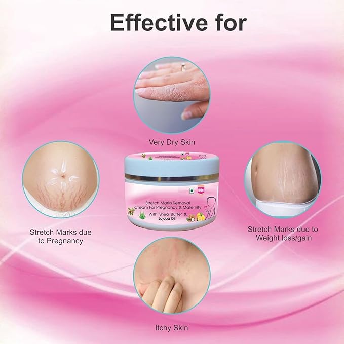 NS Herbal Care Pregnancy and Maternity Stretch Marks Removal Cream 100gm, 3.53 Ounce