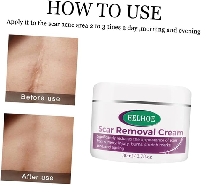 SaditY 6 Pcs Scar Repair Cream Maternity Repair Cream Scar Removal Stretch Mark Cream Stretch Marks Treatment Remove Pregnancy Cream White Abs Pregnant Woman Gel Caesarean Section