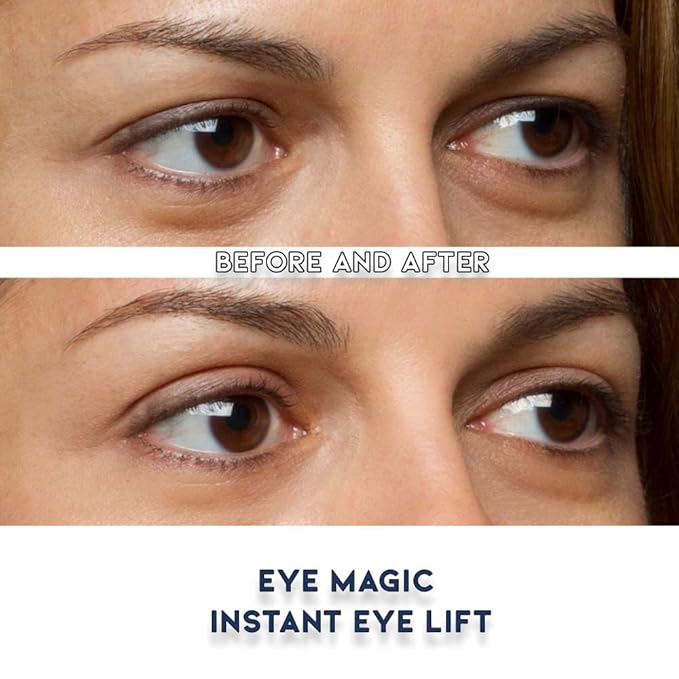 Premium Eye Lift Strips - Medium Size, 80 Count Refill Pack, Strips Only (no Gel), for Droopy, Sagging, or Hooded Eyelids, Hypoallergenic, Strong Hold, Made in USA
