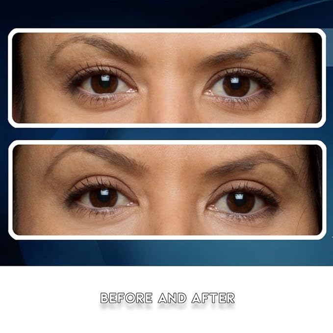 Premium Eye Lift Strips - Medium Size, 80 Count Refill Pack, Strips Only (no Gel), for Droopy, Sagging, or Hooded Eyelids, Hypoallergenic, Strong Hold, Made in USA