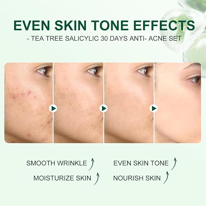 Tea Tree Salicylic Acid Facial Skin Care Set, Acne Treatment Skincare Set ,Skincare Mini Kit, Facial Kit Gifts for Women,Cleanser, Toner, Serum, Cream,Oil Control Facial Kit, Travel Size Set