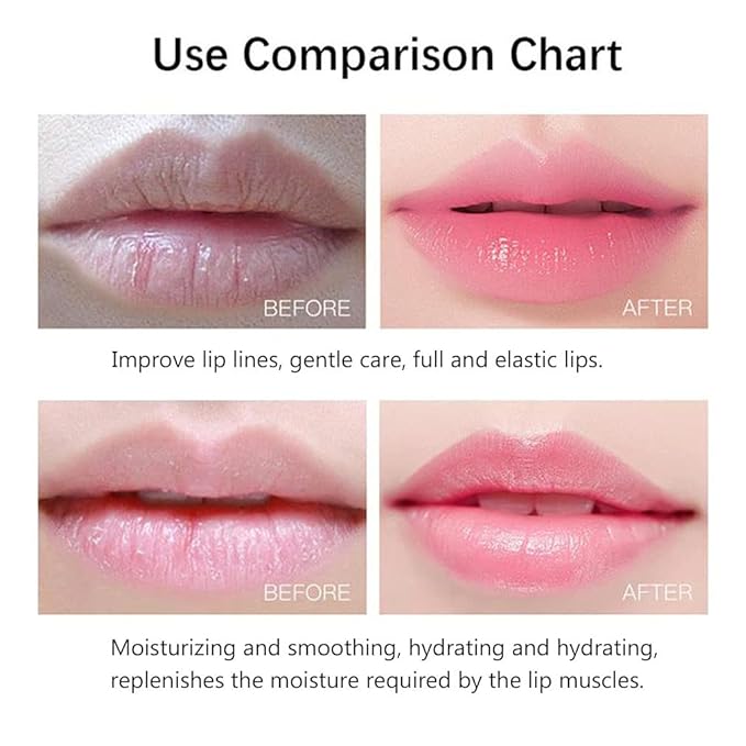 20Pcs Moisturizing/Plumping Lip Mask, Restores Moisture Mask for Dry Lips and Lines Overnight Care, Gel Treatment Masks  (Pink)