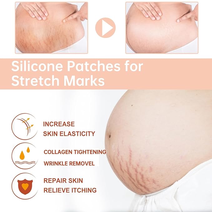 Silicone Patches for Stretch Marks, Anti Wrinkle Stretch Removal Sheet for Pregnant Women, Washable Reusable Skin Lifting & Tightening Silicone Tummy Sticker Belly Stickers Stretch Marks Pad (2pcs)