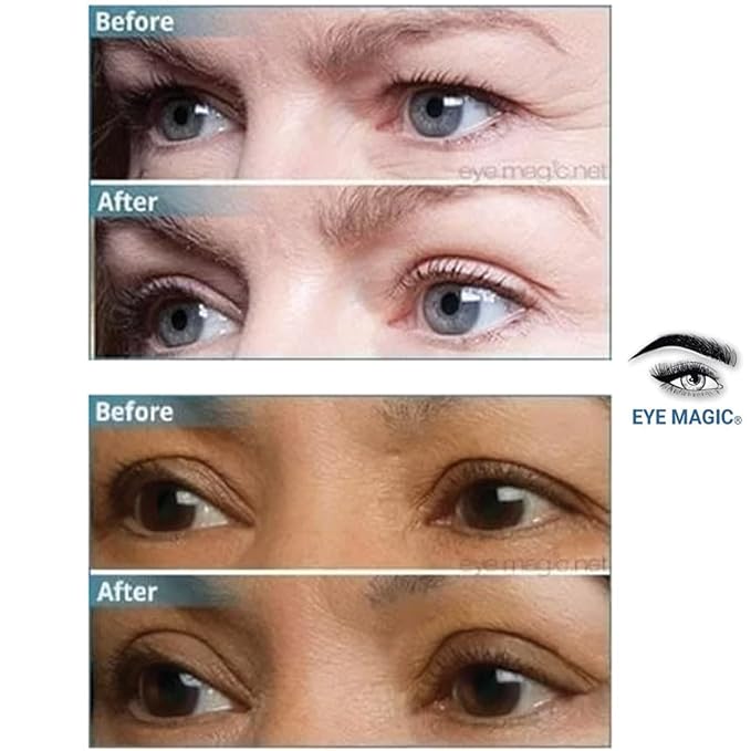 Premium Original Eye Lift Kit - Medium-Kit Size, 64 Count, Strips + Wax/Gel, Original Premium Kit, Made in USA