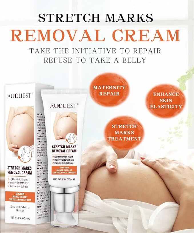 Stretch Mark Cream, Stretch Mark Prevention Cream For Pregnant Women, All Natural Ingredients, Reduce The Wrinkles Formed By Pregnancy, The Gift Of Skin Care For Pregnant Mothers (2PCS)