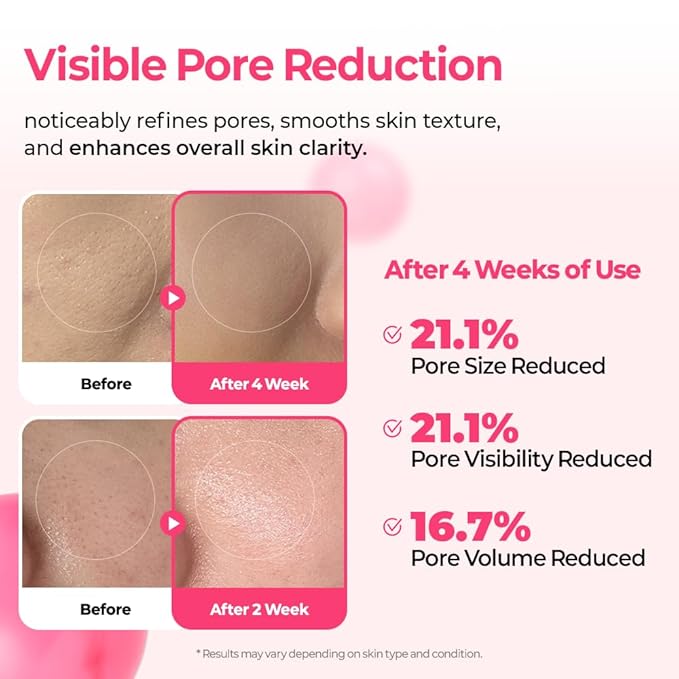 Dr.Melaxin Cemenrete Cyano Pink Spicule Serum with Calcium, korean skin care pore tightening refines spicule microneedling serum 1.01 fl. oz.