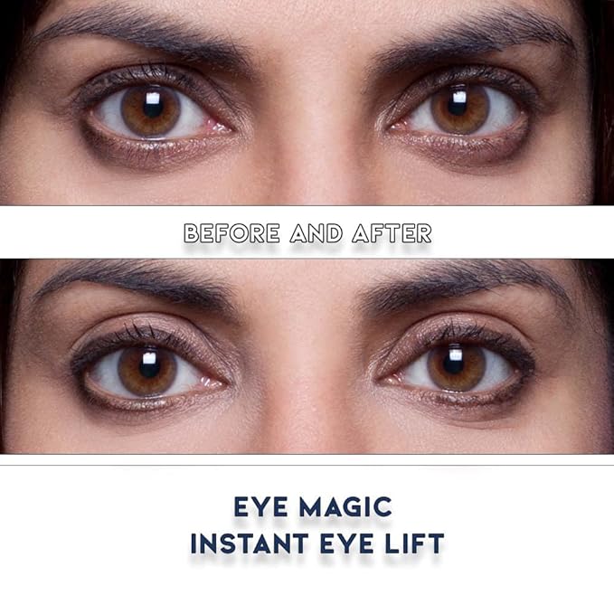 Premium Eye Lift Strips - Medium Size, 80 Count Refill Pack, Strips Only (no Gel), for Droopy, Sagging, or Hooded Eyelids, Hypoallergenic, Strong Hold, Made in USA