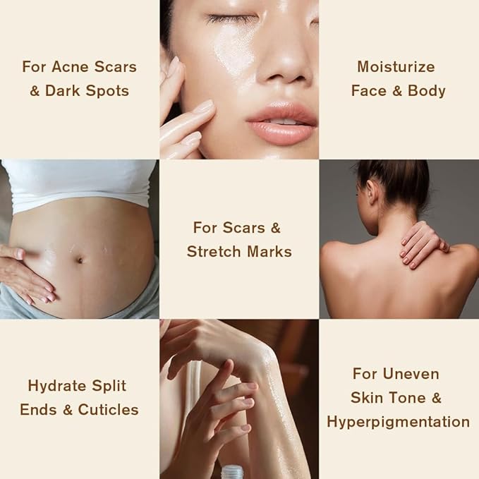 AOAO Stretch Mark Oil for Pregnancy and Body Oil for Pregnant Women, Morocco Nut Oil Help for Scars and Stretch Marks Removal and Prevention, Repair, Firming & Smoothing Fine Lines - 100ml/1pack