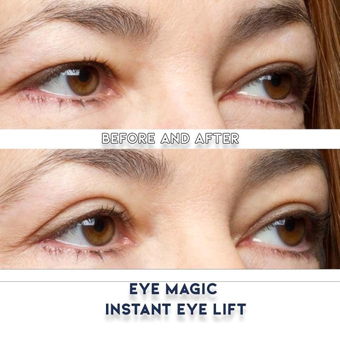 Premium Eye Lift Strips - Medium Size, 80 Count Refill Pack, Strips Only (no Gel), for Droopy, Sagging, or Hooded Eyelids, Hypoallergenic, Strong Hold, Made in USA