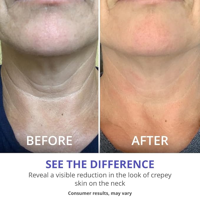 goPure Tighten & Lift Neck & Chest Moisturizer Cream for Visibly Firming, Tightening and Lifting Wrinkles & Crepey Skin, 1.7oz - Pack of 2
