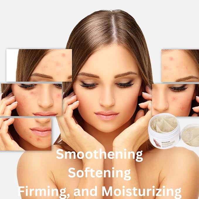 Skin Revival Advanced Anti Stretch Mark, Acne & Scar Cream - Moisturizing, Nourishing, Even Toning and Cocoa Butter & Shea Butter Infused, 4 oz.