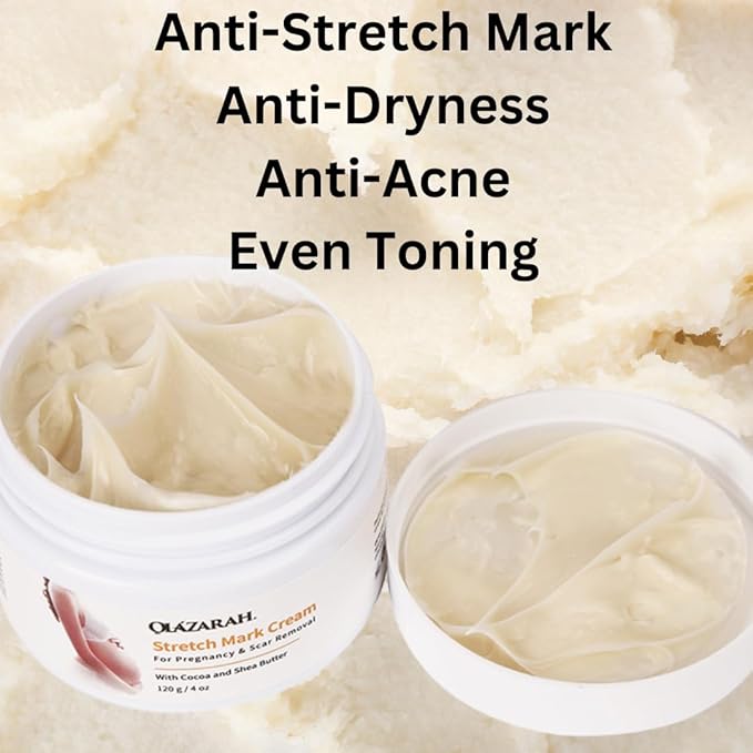 Skin Revival Advanced Anti Stretch Mark, Acne & Scar Cream - Moisturizing, Nourishing, Even Toning and Cocoa Butter & Shea Butter Infused, 4 oz.