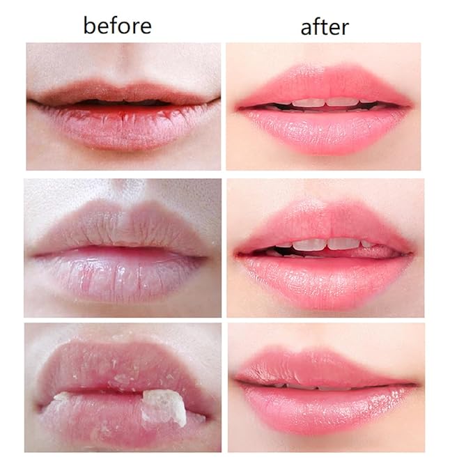 4 PCS Bee Lip Balm Honey Pot,Propolis Lip Mask Moisturizing Moisture Nourishing Dry & Chapped,Care and Reduces Lines, Exfoliating (Honey)