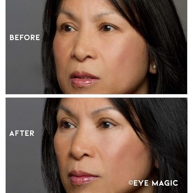 Premium Eye Lift Combo Pack - Med+Large Size, 128 Count, Strips Only, 2 Sizes Combo Pack, Best Value, Made in USA