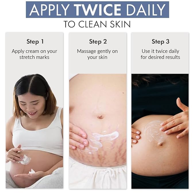 Anveya Stretch Marks Expert Serum Cream | Prevents & Reduces Appearance of New (Red) and Old (White) Stretchmarks | Powered by Striover™, Rosehip Oil & Squalane | Vegan and Cruelty-free | For Men