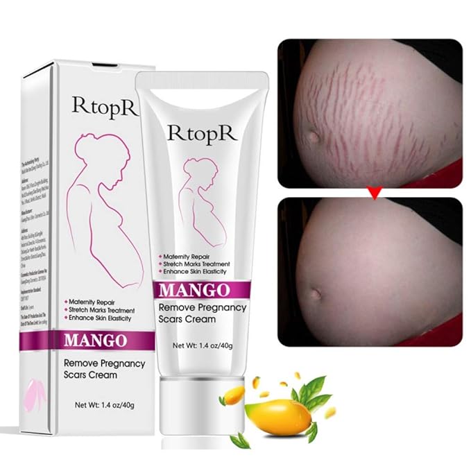 Ofanyia Stretch Mark Removal Cream Repair Scars Stretch Marks Remove Pregnancy Scar Cream