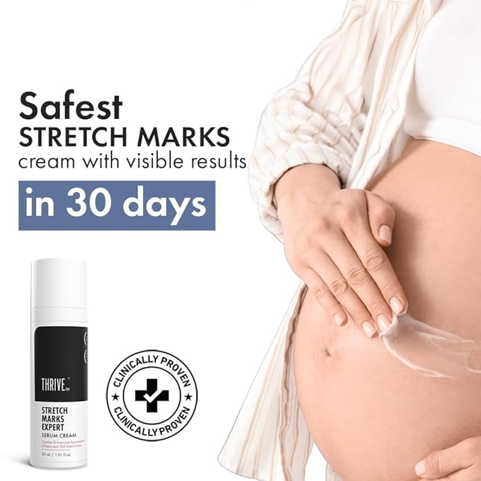 Anveya Stretch Marks Expert Serum Cream | Prevents & Reduces Appearance of New (Red) and Old (White) Stretchmarks | Powered by Striover™, Rosehip Oil & Squalane | Vegan and Cruelty-free | For Men