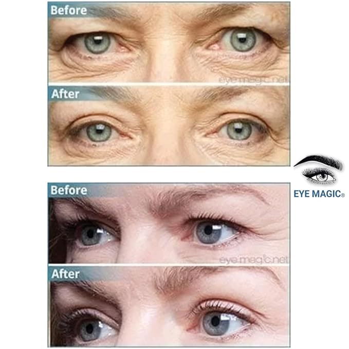 Premium Original Eye Lift Kit - Medium-Kit Size, 64 Count, Strips + Wax/Gel, Original Premium Kit, Made in USA