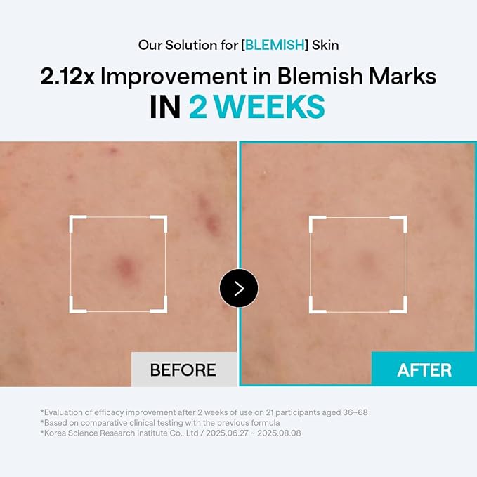 MEDIHEAL Madecassoside Blemish Pad - Square Cotton Facial Toner Pads with Centella Asiatica & Madecassoside – Anti Blemish to Improve Uneven Skin Tone - Vegan Face Gauze Pads, 100
