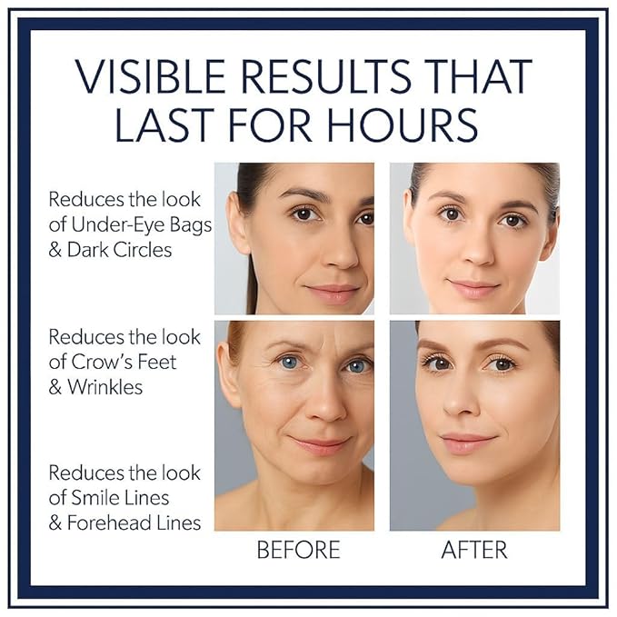 Instant Firming Eye Serum, Anti-Aging Formula for Under Bags and Wrinkles, Under Eye Cream-10ml,0.35 oz, Wrinkle Filler, Visibly Improves for Bags Dark Circles Treatment for Puffines (Unscented 2)