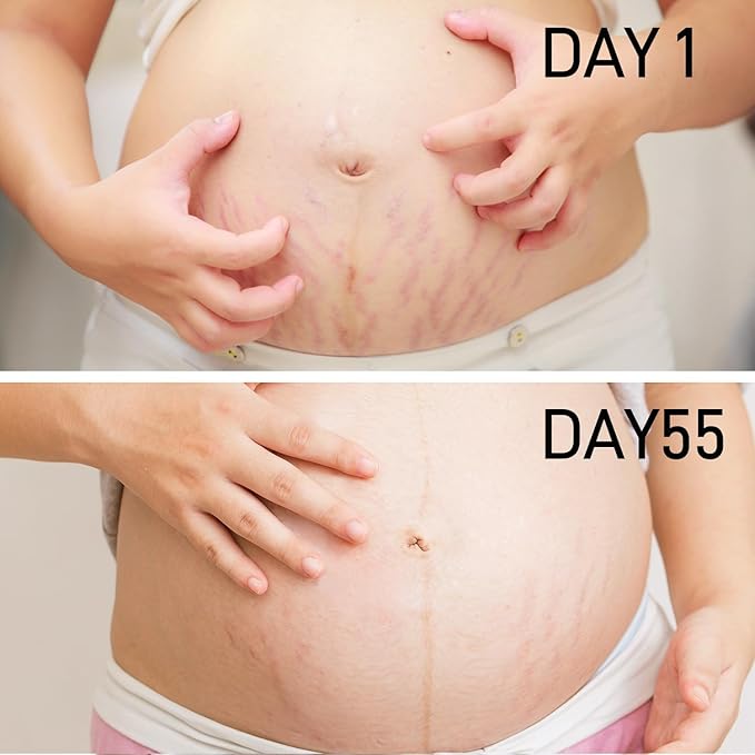 Stretch Mark Cream for Pregnancy & Postpartum,with Argan Oil, Shea Butter & Vitamin E,Stretch Mark Prevention for Belly,Moisturize Skin,Prevent & Fade stretch marks (100ml_1PACK)