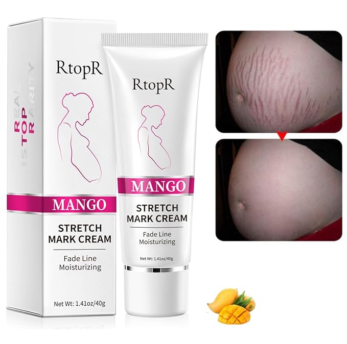 1 PCS Stretch Marks and Scar Cream, Stretch Mark and Scar Removal Cream for Pregnancy, Belly Creams for Wrinkles, Obesity Fat Marks Scars Moisturizing, Remove Marks