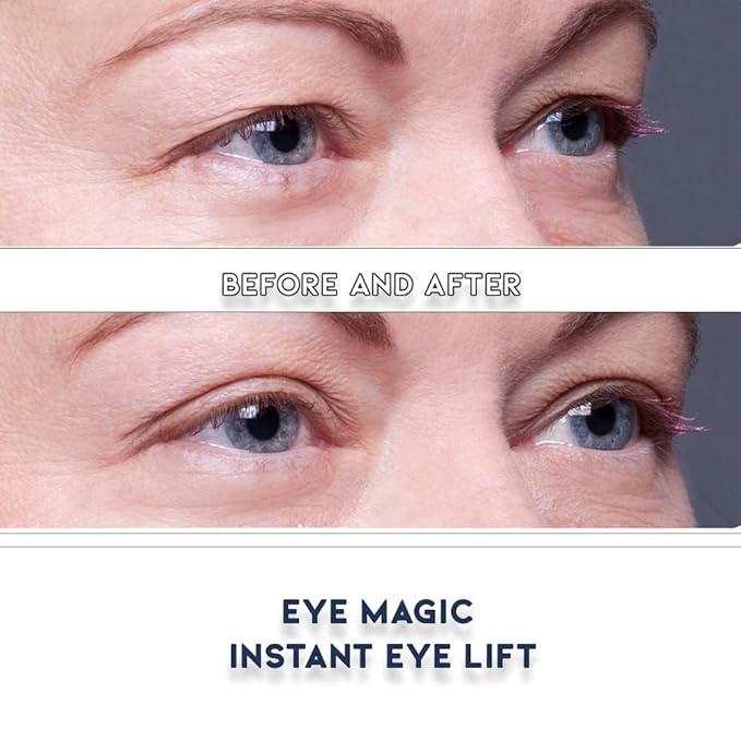 Premium Instant Eyelid Lift (L/XL-Refill). Look Younger Instantly | Made in America - Lifts and Defines Droopy, Sagging, Hooded Eyelids For A Youthful Look
