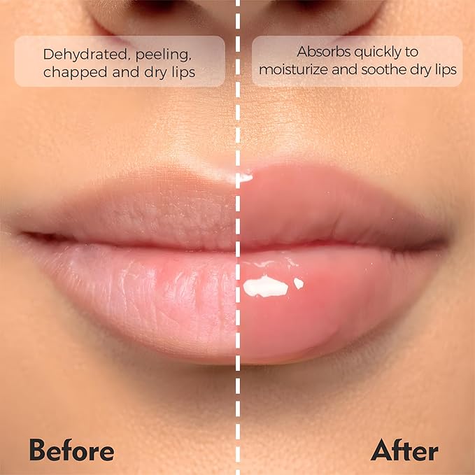 Deep Hydrating Lip Butter Balm- Glossy Lip Treatment with Shea Butter, Vitamin E, Peptides & Hyaluronic Acid - Vegan, Non-Sticky, Moisturizing Lip Care | 2-Pack (Clear-Unscented)