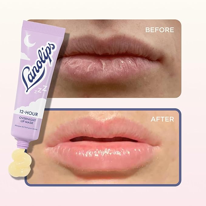 Lanolips 12 Hour Overnight Lip Mask - Rich Lanolin Lip Balm with Hyaluronic Acid, Vitamin C & Ceramides - Restore, Soften & Replenish While You Sleep - Cruelty-Free Hydrating Balm (0.52 oz / 15 g)