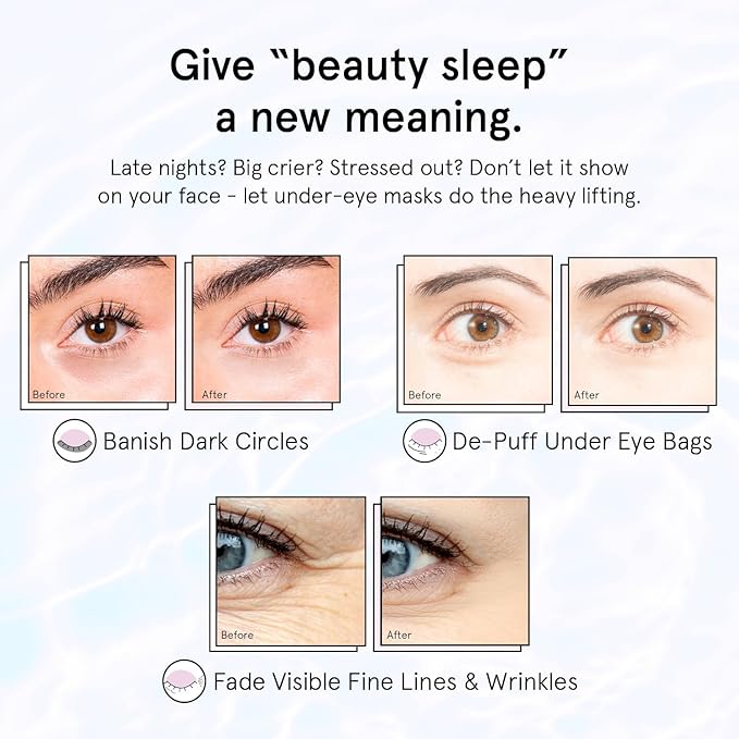 grace & stella Retinol Under Eye Patches for Puffy Eyes & Dark Circles - Restoring Gel Under Eye Masks with Hyaluronic Acid - Bridesmaid Gifts, Birthday Gifts for Women (Purple, 24 Pairs)