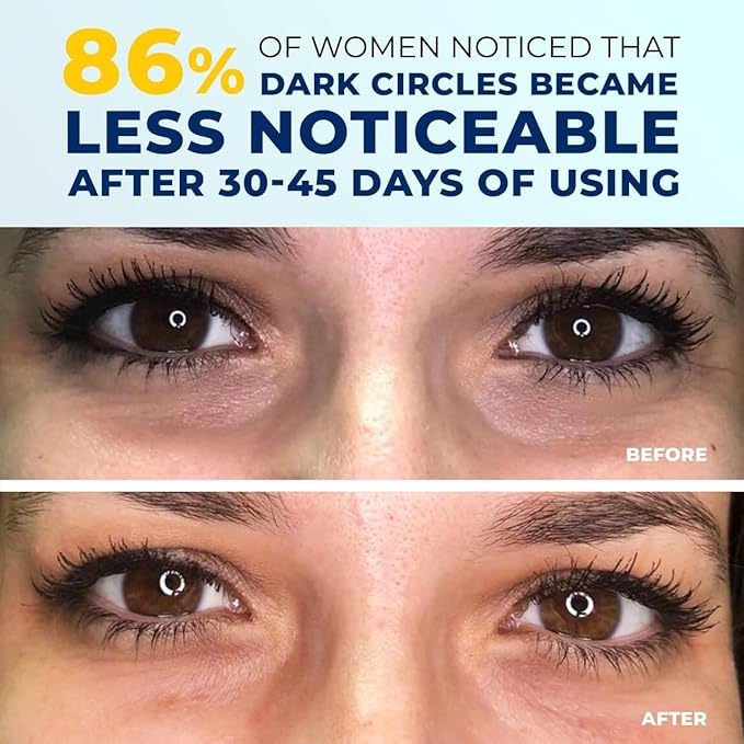 Under Eye Brightener for Dark Circles – 4 in 1 with Niacinamide, 5% Caffeine, Retinol & Peptides - Eye Cream Anti Aging for Reduce Wrinkles, Puffiness and Bags Under Eyes