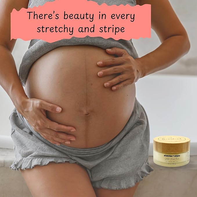 Stretchies and Stripes Stretch Mark Balm | Intense Relief | Pregnancy Safe