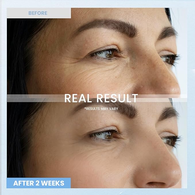 Retinol Eye Cream for Dark Circles: Anti-Wrinkle Under Eye Cream - Night Care Eye Cream Reduces Eye Bags 0.5 fl. oz