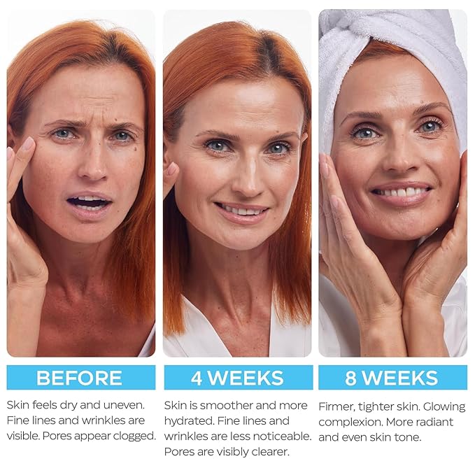 Retinol Cream for Face with Hyaluronic Acid, Day-Night Anti-Aging Moisturizer for Women, Men, Collagen Cream for Face Reduces Wrinkles, Dryness, 1.85 Oz