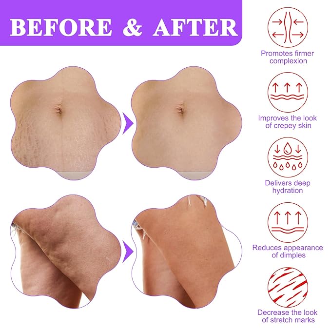 Tighten & Smooth Belly Cream - Tighten and Lift Neck Cream, Advanced Firming Lotion for Arms, Butt & Thighs | Visibly Lift Loose Skin, Improve Elasticity & Tone