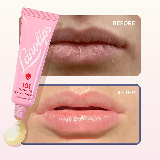 Lanolips 101 Ointment - Lanolin Lip Balm for Smooth, Hydrated & Healthy Lips - Multipurpose Lip Ointment with Lanolin Oil for Dry Lips, Cuticles & More - Strawberry (0.52 oz)