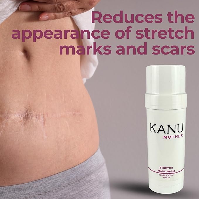 Mother Stretch Mark Balm for Pregnancy by Kanu- 3.3 oz- Deeply Hydrating & Nourishing Belly Butter- Reduces the Appearance of Stretch Marks- Enriched with Shea Butter, Cocoa Butter and Vitamin E