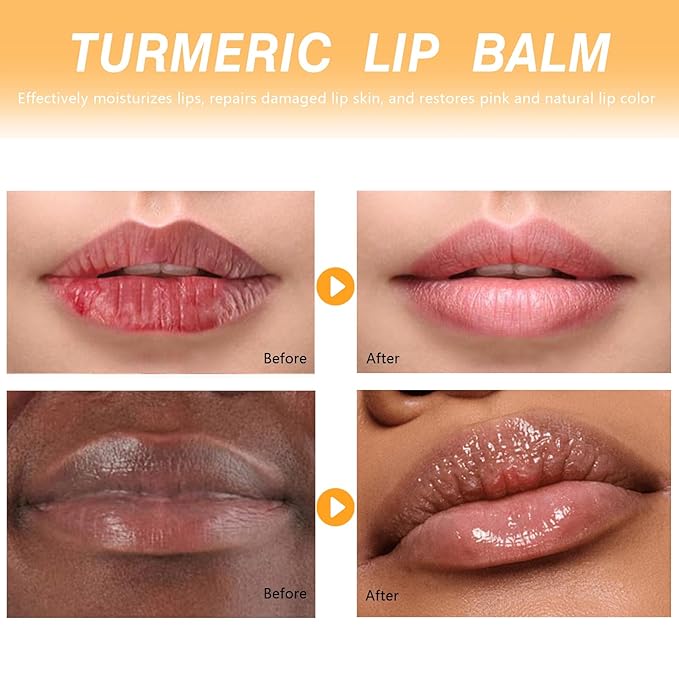 Turmeric Lip Balm for Smokers Dark Lip Treatment with Turmeric oil, Help Fade Lip, Lip Exfoliator, Long-Lasting Natural Balm Moisturize & Nourish Dry, Cracked, Dull, Reduce Fine Lines Lip
