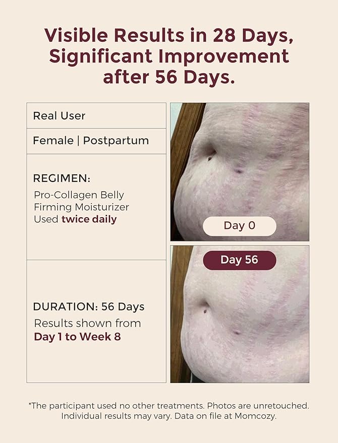 Momcozy Stretch Mark Cream for Sensitive Skin, 5-Day Trial Pack, Organic Meadowfoam Seed Oil, Natural Skincare, Massage Moisturizer, 0.9 oz (5 x 5g Sachets)