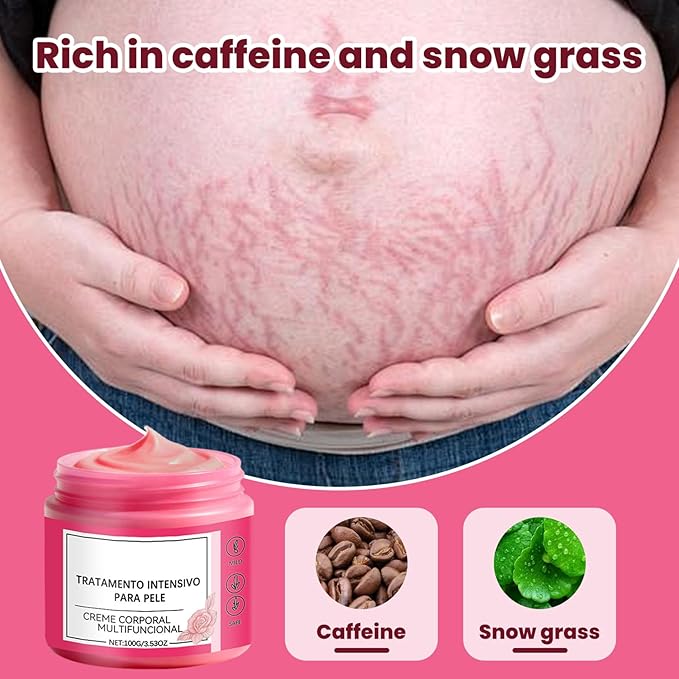 Pregnancy Stretch Mark Cream - Belly Butter for Pregnancy Improve Skin's Appearance 100g Rose Scented Moisturizer for Daily Skin Care, 3Pcs